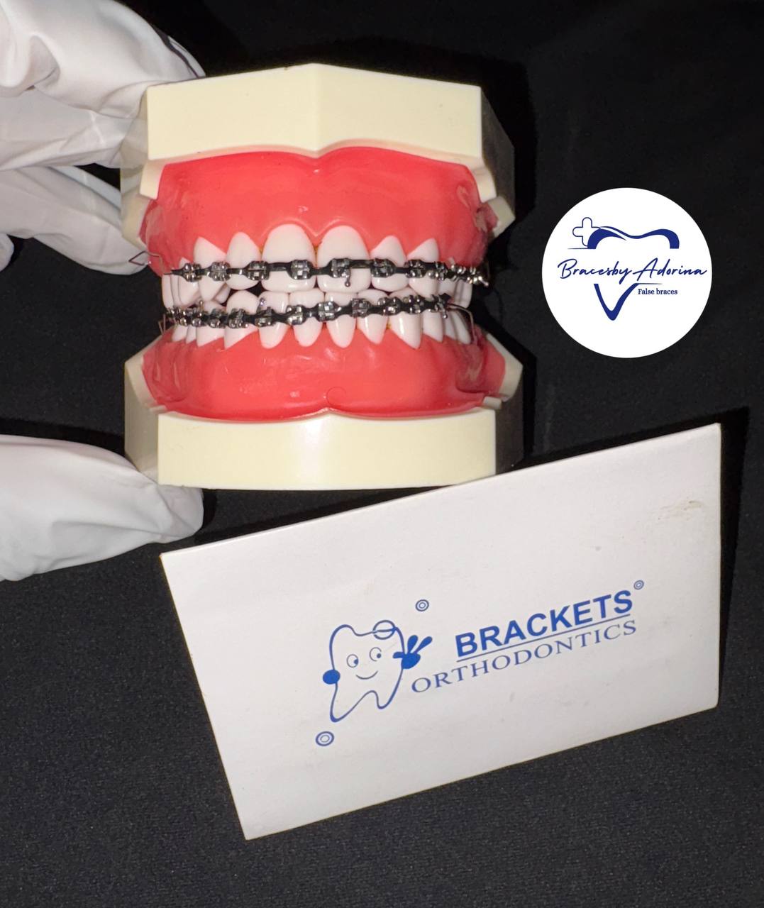 ⭐️Powerchain Clip-on Braces. Top and Buttom Set⭐️