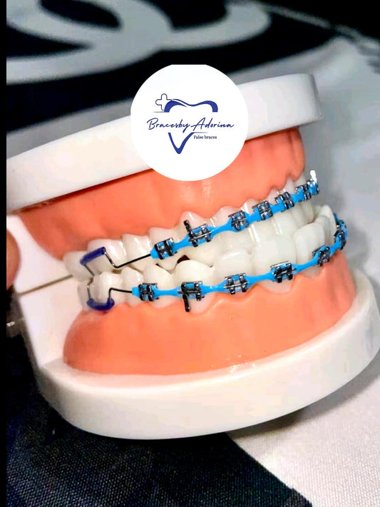 ⭐️Powerchain Clip-on Braces. Top and Buttom Set⭐️